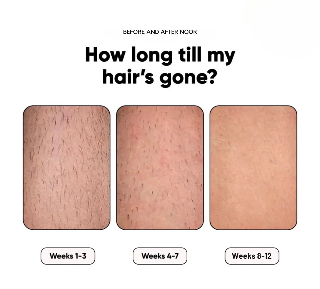 GlowSilk IPL Hair Removal Handset